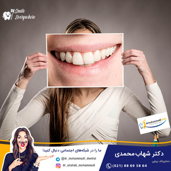 قیمت کامپوزیت دندان - کلینیک دندانپزشکی دکتر شهاب محمدی
